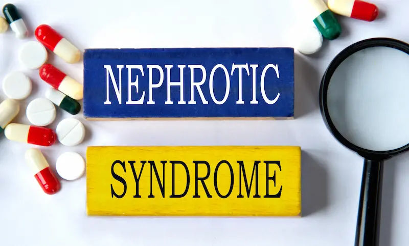 Nephrotic Syndrome Overview and Management Options